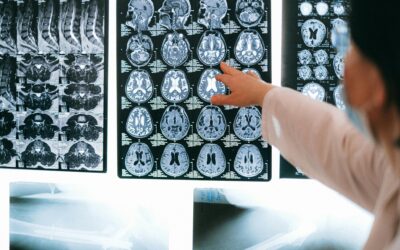 Hipnosis y Neurociencia: Cómo la hipnosis cambia el cerebro y mejora la mente según la ciencia.